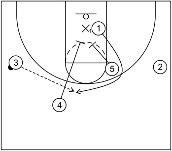Offensive Counter - Example 1 - Part 2 - Back Screen