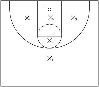 1-1-3 zone defense implemented during a basketball period