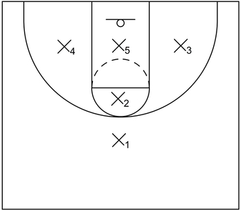 1-1-3 Zone Example