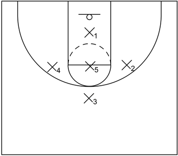 1-3-1 Zone Example