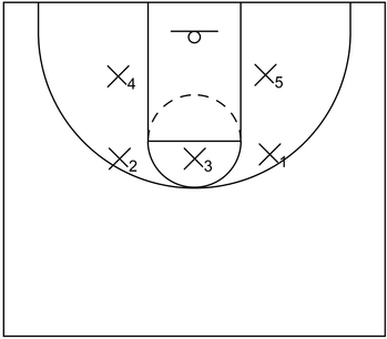 3-2 Zone Example
